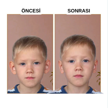 Fizolab® Kepçe Kulak Bandı