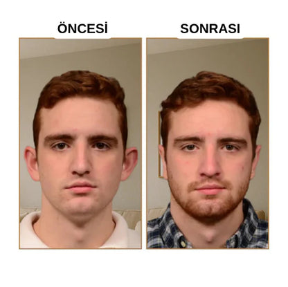 Fizolab® Kepçe Kulak Bandı