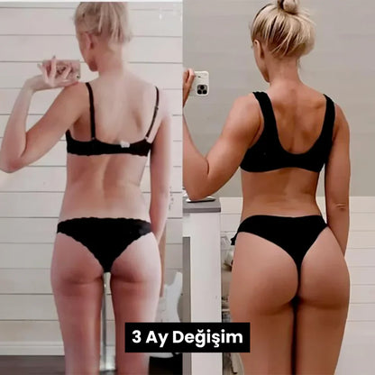 Fizolab® Kalça Şekillendirici