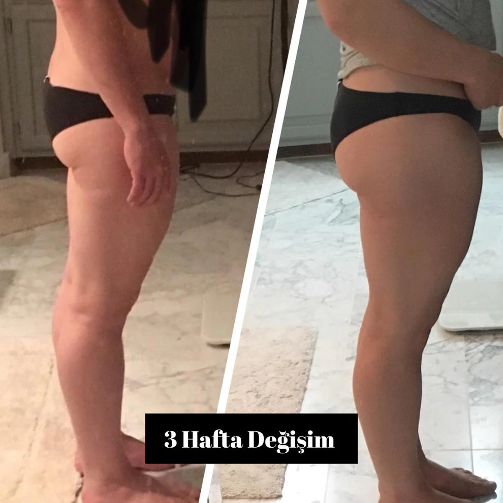 Fizolab® Kalça Şekillendirici