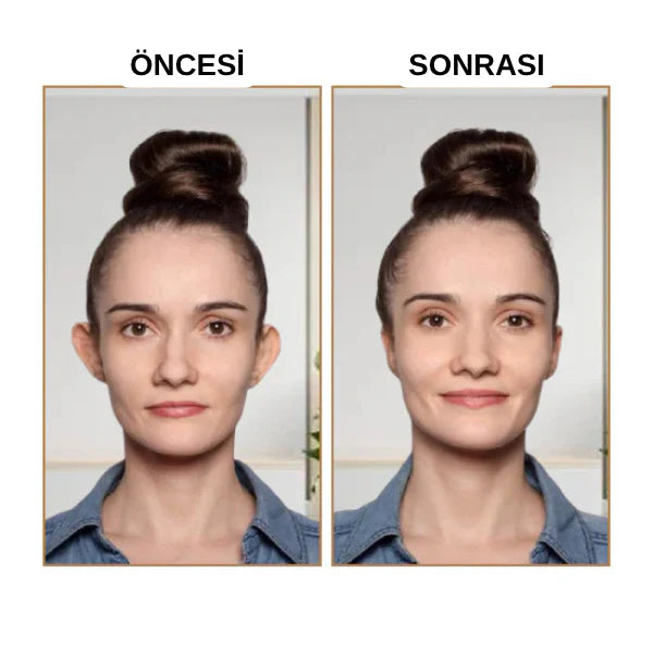 Fizolab® Kepçe Kulak Bandı