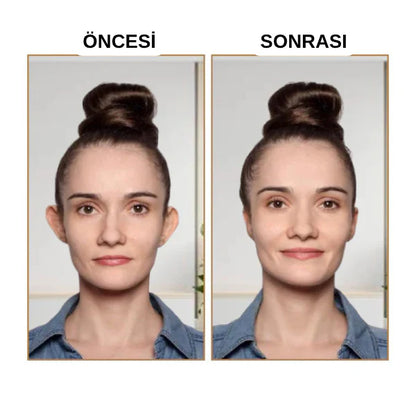 Fizolab® Kepçe Kulak Bandı